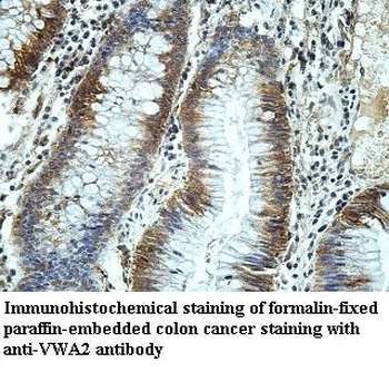 VWA2 Rabbit Polyclonal Antibody