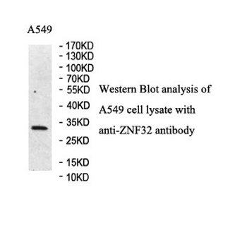 ZNF32 Rabbit Polyclonal Antibody