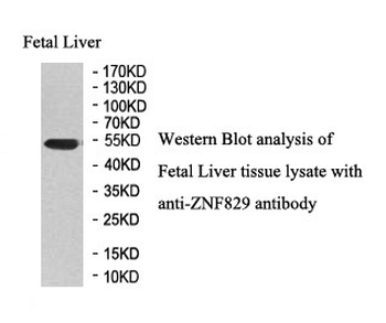 ZNF829 Rabbit Polyclonal Antibody