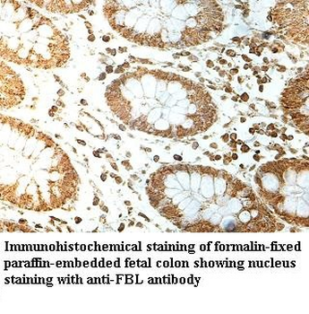 ZPBP2 Rabbit Polyclonal Antibody