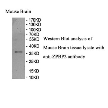 ZPBP2 Rabbit Polyclonal Antibody