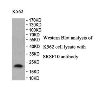 FUSIP1 Rabbit Polyclonal Antibody