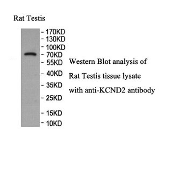 KCND2 Rabbit Polyclonal Antibody