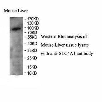 SLC4A1 Rabbit Polyclonal Antibody