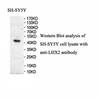 LHX2 Rabbit Polyclonal Antibody