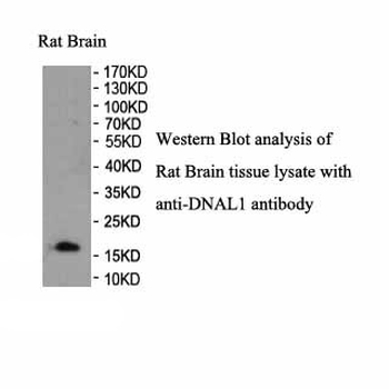 DNAL1 Rabbit Polyclonal Antibody