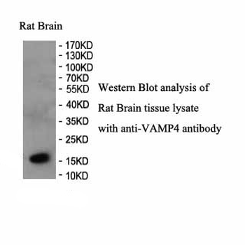 VAMP4 Rabbit Polyclonal Antibody