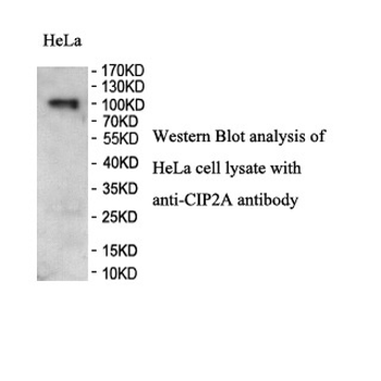 CIP2A Rabbit Polyclonal Antibody