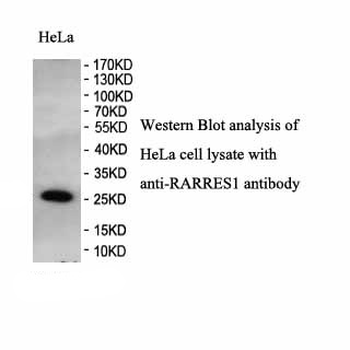 RARRES1 Rabbit Polyclonal Antibody