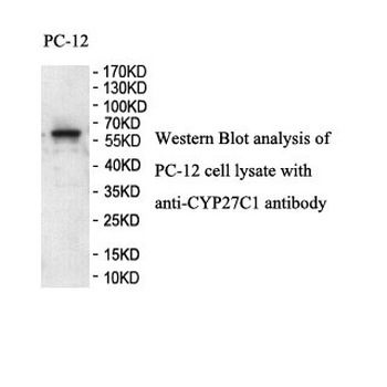 CYP27C1 Rabbit Polyclonal Antibody