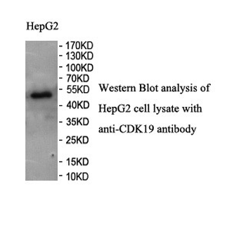 CDK19 Rabbit Polyclonal Antibody