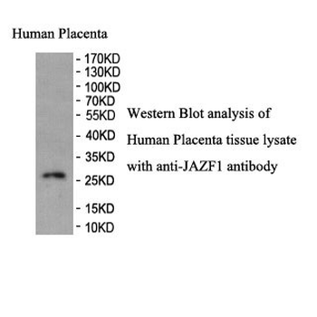 JAZF1 Rabbit Polyclonal Antibody