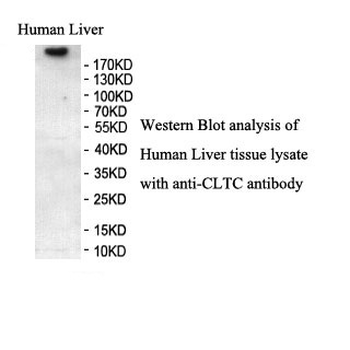 CLTC Rabbit Polyclonal Antibody