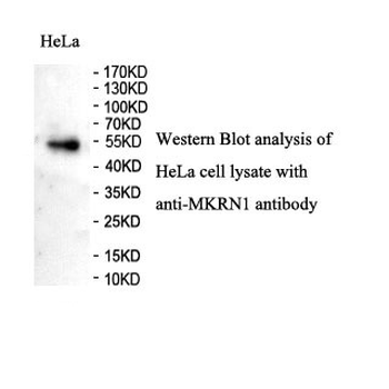 MKRN1 Rabbit Polyclonal Antibody