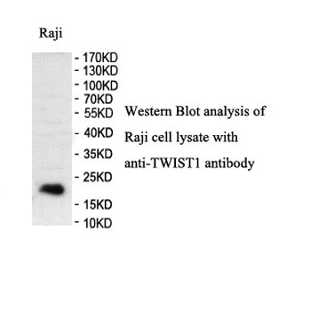 TWIST1 Rabbit Polyclonal Antibody
