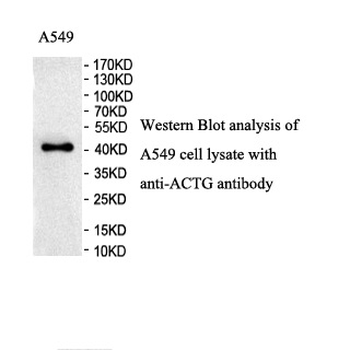 ACTG Rabbit Polyclonal Antibody