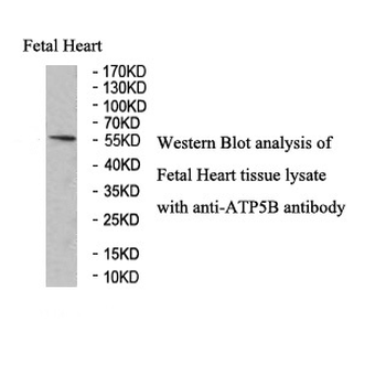 ATP5B Rabbit Polyclonal Antibody