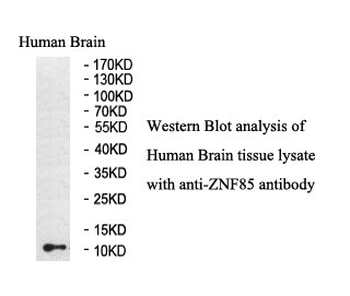ZNF85 Rabbit Polyclonal Antibody
