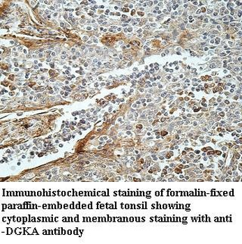 DGKA Rabbit Polyclonal Antibody