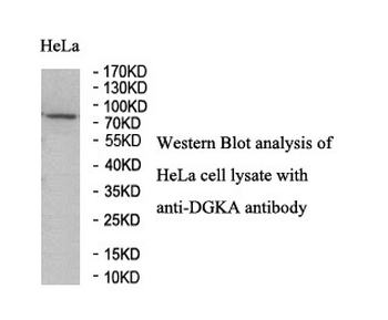 DGKA Rabbit Polyclonal Antibody