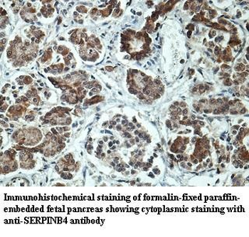 SERPINB4 Rabbit Polyclonal Antibody