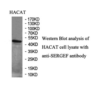 SERPINB4 Rabbit Polyclonal Antibody