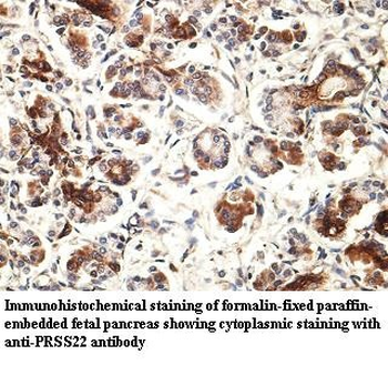 PRSS22 Rabbit Polyclonal Antibody