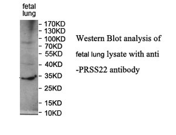 PRSS22 Rabbit Polyclonal Antibody