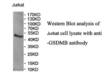 GSDMB Rabbit Polyclonal Antibody