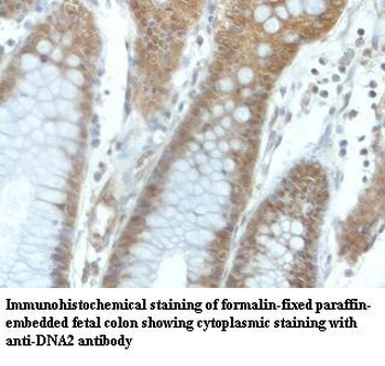DNA2 Rabbit Polyclonal Antibody