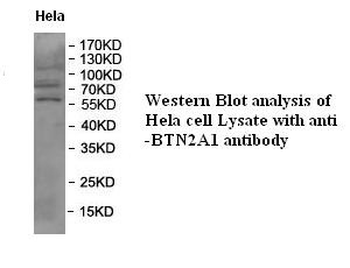 BTN2A1 Rabbit Polyclonal Antibody