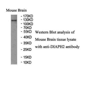 DIAPH2 Rabbit Polyclonal Antibody