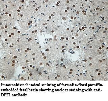 DPF1 Rabbit Polyclonal Antibody