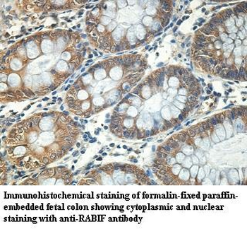 RABIF Rabbit Polyclonal Antibody