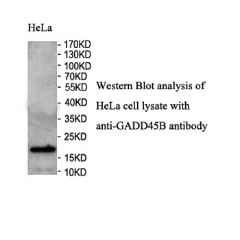 GADD45B Rabbit Polyclonal Antibody
