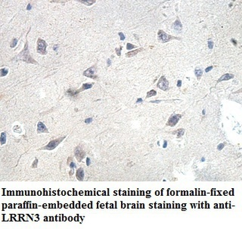 LRRN3 Rabbit Polyclonal Antibody