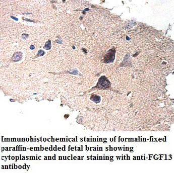 FGF13 Rabbit Polyclonal Antibody
