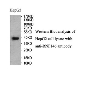 RNF146 Rabbit Polyclonal Antibody