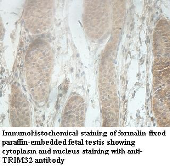 TRIM32 Rabbit Polyclonal Antibody