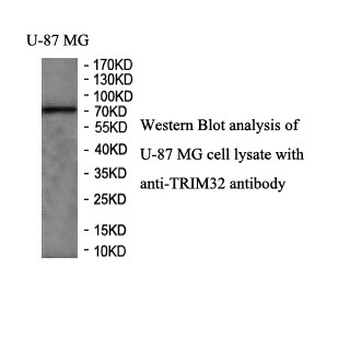 TRIM32 Rabbit Polyclonal Antibody