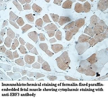 EBF3 Rabbit Polyclonal Antibody