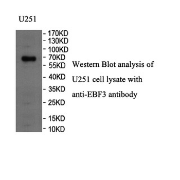 EBF3 Rabbit Polyclonal Antibody