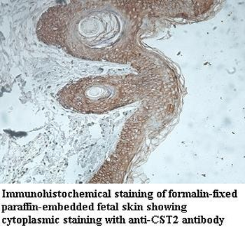 CST2 Rabbit Polyclonal Antibody