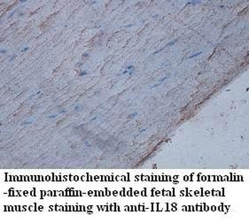 IL18 Rabbit Polyclonal Antibody