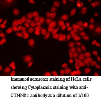 CTNNB1 Rabbit Polyclonal Antibody