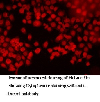 Dicer1 Rabbit Polyclonal Antibody