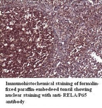 RELA Rabbit Polyclonal Antibody