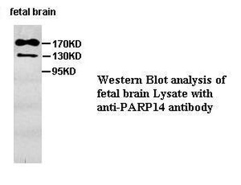 PARP14 Rabbit Polyclonal Antibody
