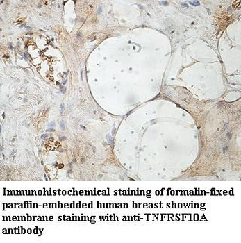 TNFRSF10A Rabbit Polyclonal Antibody