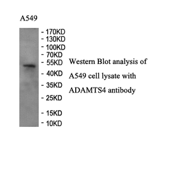 ADAMTS4 Rabbit Polyclonal Antibody